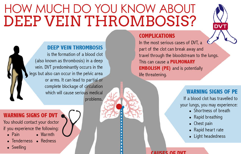 Infographics About Blood Clots