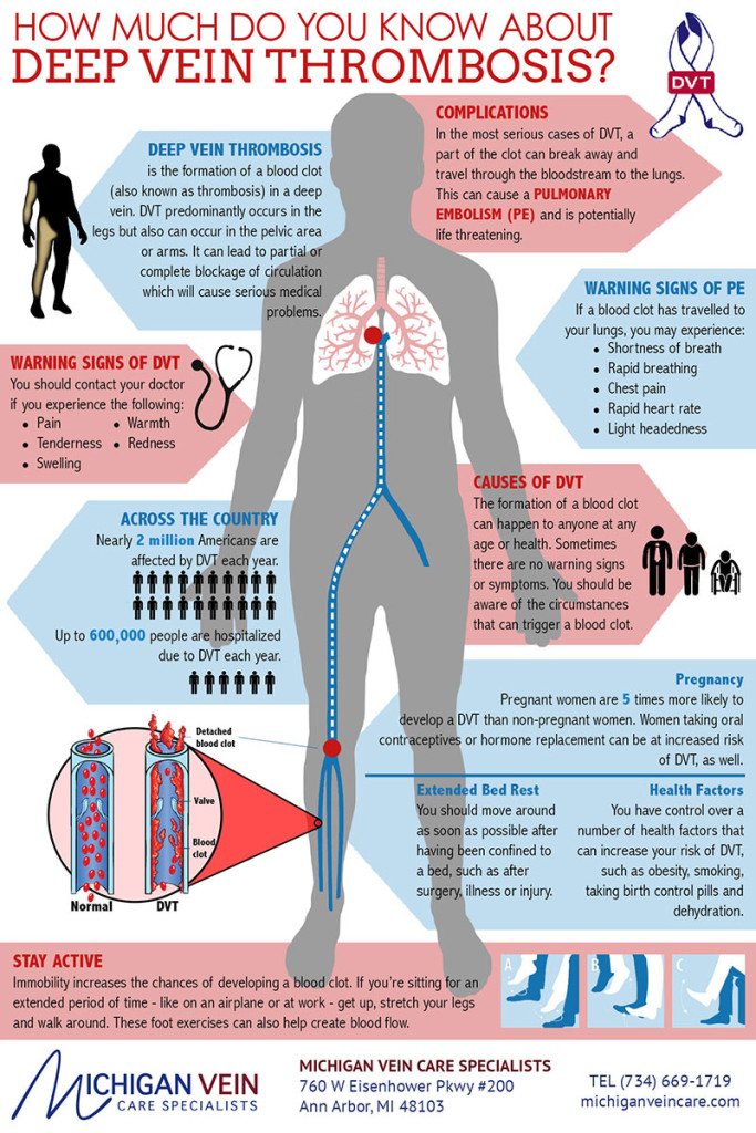 Deep Vein Thrombosis Infographic