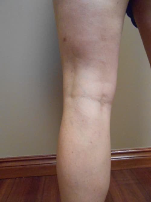 After Image: RFA - back