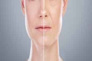 Collage before-and-after of woman’s face for skincare, anti-aging, beauty surgery, Jeuveau treatment, on gray background
