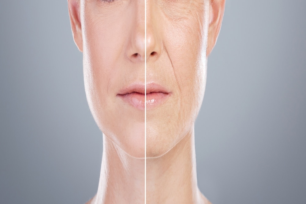 Collage before-and-after of woman’s face for skincare, anti-aging, beauty surgery, Jeuveau treatment, on gray background